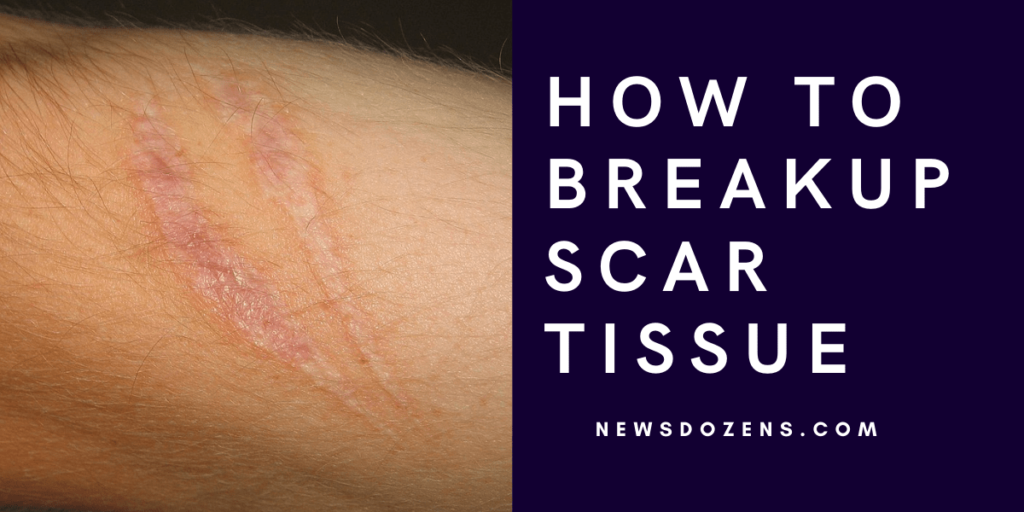 The Millionaire Guide On How To Breakup Scar Tissue